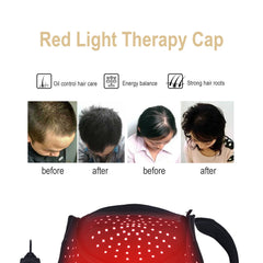 FREYARA 216-LED Red & Near-Infrared Hair Growth Therapy Hat