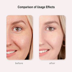 FREYARA FacialDefy 3.0 Lite Eye & Face HIFU Device