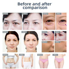 Mini 3in1 RF Beauty Device Rejuvenation Lifting Wrinkle Removal Skin Tightening for Face Eye Skin