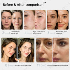 FREYARA 480-LED Face & Neck Light Therapy Mask