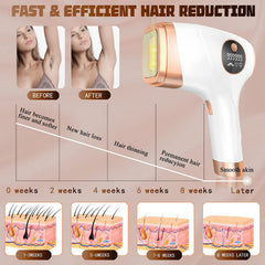 IPL Laser Hair Removal Permanent at Home, Ice Painless for Full Body, 999999 Flashes, 5 Levels, FDA Certified, CA Plug